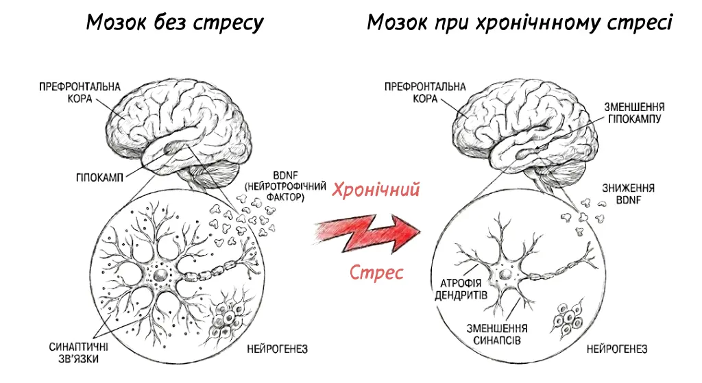 Зміни в мозку під час хронічного стресу